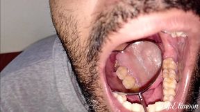 Showing you my "patient's" teeth with a large mirror (close-up) Playing dentist Dirty teeth