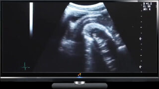 Par, uten kondom, kuker, lege, medisinsk – gutter med store pikk knuller i rumpa