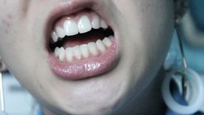 Aurora's Teethy Seduction