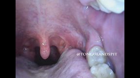 Logan Endoscope Mouth Part21 Video1 - WMV