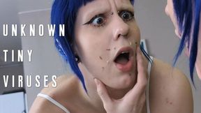 Unknown tiny viruses.