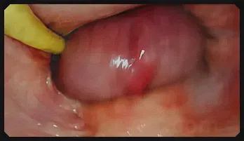 Intense Internal POV Creampie – Up-Close Pussy Action