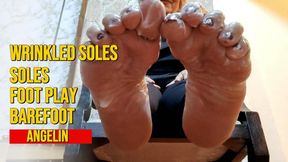 Very wrinkled soles covered with creamy white liquid (1)