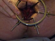 Anal traing with dialator spreader