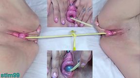 German mature lesbians share painful prolapse penetration