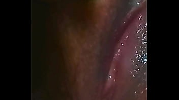 Concha h&uacute_meda