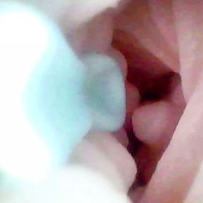 A detailed examination of Lopuza93 Vagina area using an endoscope camera.