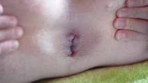 Asshole Closeup