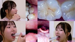 Kana Yura - Observing Kana's teeth, mouth, and back of the throat with a dental camera - MOV 1080p