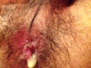 culito peludo se dilata mucho jugando con mi dildo