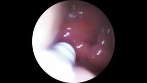 Camera Inside My Wife's Pussy and Squirt