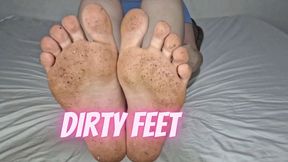 Dirty feet