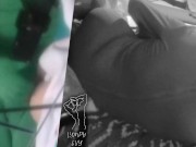 Amputee w/ Unique Disability Gets Rock Hard and Cums