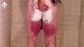 1 day after a judicial caning
