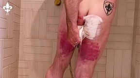1 day after a judicial caning