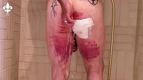 1 day after a judicial caning