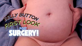 Belly Button First Look  Post Surgery