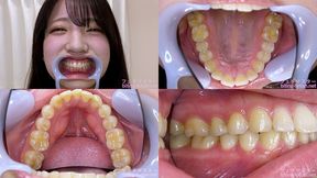 Sara Issiki - Watching Inside mouth of Japanese cute girl