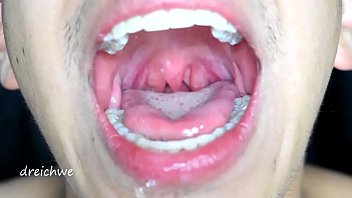 Large uvula and hot