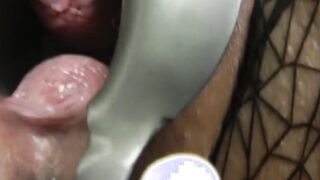 Speculum inside snatch