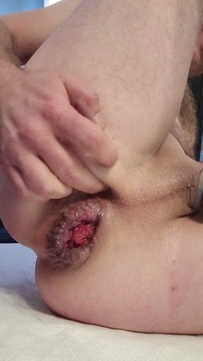 Huge dildo gape. Anal pound with Squarepeg jammer   Clip 3