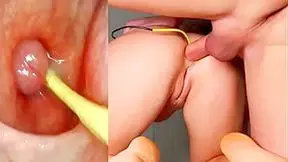 Amazing Anal Camera In Her Ass Deep Anal Fuck And Internal Creampie - Sergy Loven