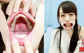 Ikumi Kuroki's Vulnerable Revelation: a Journey Into Dental Sensitivities and Unveiled Imperfections