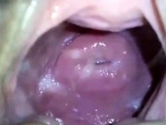 my japanese girlfend's cute cervix in huge hole