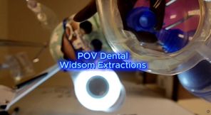 POV Professional Dental Wisdom Teeth Extractions 🧤🦷🪥