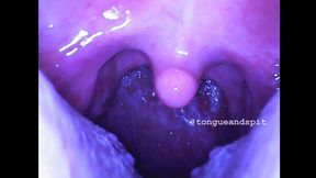 William Endoscope Mouth NO AUDIO Part20 Video1 - WMV