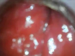 anal endoscope ass play from inside