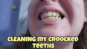 Brushing My Yellow Crooked Teeth, Fetish for Imperfect Smiles and Oral Close-Up Play