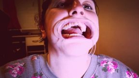 Preparing for Invisible Aligners