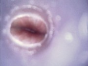 Internal views - Endoscope inside ass , cock , mouth - endoscope anal insertion, urethral insertion