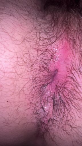 Bruised Asshole
