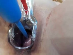 Show with cervix opened with speculum