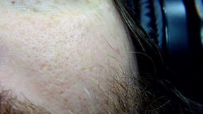 New Close-up with a New Camera