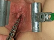 Female Urethral Sounding Orgasm Stretched &amp; Clamped Pussy S&amp;M Medical Play
