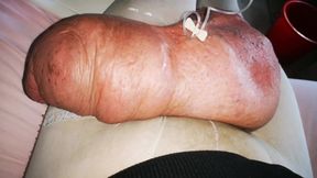 Another Huge Infussion