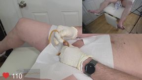 Foley Catheter and Bladder Filling