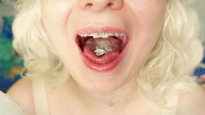 asmr video: eating in braces - food fetish