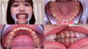 Mai Onodera - Watching Inside mouth of Japanese cute girl - MOV