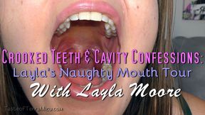 Crooked Teeth & Cavity Confessions: Layla's Naughty Mouth Tour - Layla Moore - MP4 720 HD