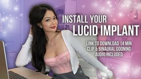 Install Your Lucid Implant