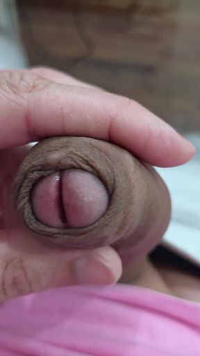 The Head of My Penis