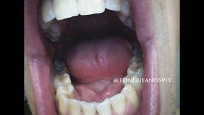 Logan Endoscope Teeth Part21 Video1 - WMV