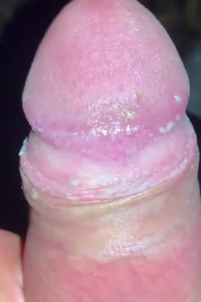 Under Foreskin Cheesy Cock Cums Onto Ground Outdoor