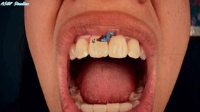 Just food stuck to her teeth! GM mouth views, tiny trapped on tongue! - MOV