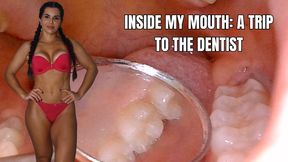 Inside my mouth: a trip to the dentist - OnlyVanessa
