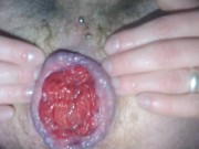 Gay guy plays with his cummy prolapse